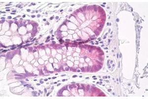 Image no. 1 for anti-Glutathione Peroxidase 2 (GPX2) antibody (ABIN1502290) (Glutathione Peroxidase 2 抗体)