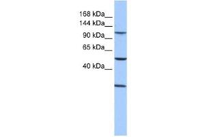STAG3 antibody used at 1 ug/ml to detect target protein. (STAG3 抗体  (Middle Region))