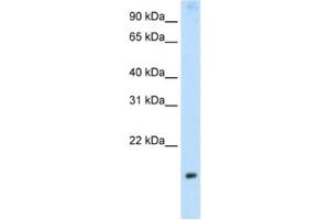 Western Blotting (WB) image for anti-Protein Phosphatase 1, Regulatory Subunit 8 (PPP1R8) antibody (ABIN2462127) (PPP1R8 抗体)