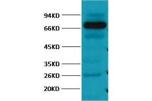 Western Blot (WB) analysis of Pig Skeletal Muscle with HSP70 Monoclonal Antibody diluted at 1:2000. (HSP70 抗体)