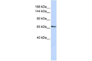 WB Suggested Anti-RBM26 Antibody Titration:  0. (RBM26 抗体  (Middle Region))