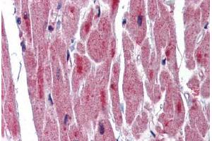 Human Heart: Formalin-Fixed, Paraffin-Embedded (FFPE) (RBM24 抗体  (C-Term))