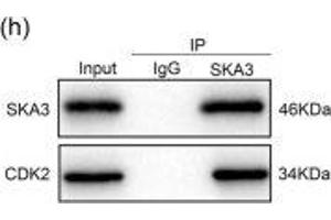 SKA3 inhibited the interaction between CDK2 and p53. (SKA3 抗体  (AA 201-300))