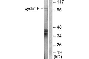 Western blot analysis of extracts from HeLa cells, using Cyclin F antibody (ABIN5976376). (Cyclin F 抗体  (C-Term))