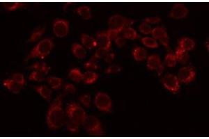 ABIN6276072 staining LOVO by IF/ICC. (OR11L1 抗体  (Internal Region))