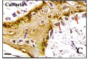 Immunohistochemistry image of BSP staining in paraffn sections of human calvaria. (BSP 抗体)