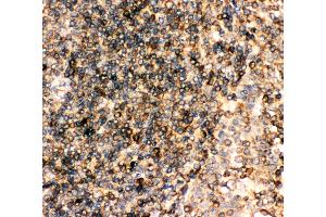 Immunohistochemistry (IHC) image for anti-Fc Fragment of IgE, Low Affinity II, Receptor For (CD23) (FCER2) (AA 50-331) antibody (ABIN3043829)