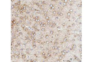 IHC analysis of MFF using anti-MFF antibody (ABIN7599292). (MFF 抗体  (AA 1-342))