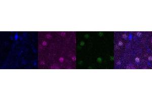 Immunohistochemistry (IHC) image for anti-SATB Homeobox 2 (SATB2) antibody (ABIN7456088) (SATB2 抗体)