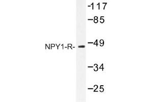 Image no. 1 for anti-Neuropeptide Y Receptor 1 (NPY1R) antibody (ABIN317656) (NPY1R 抗体)