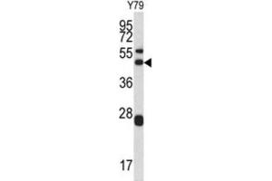 Western Blotting (WB) image for anti-Actin Related Protein 2/3 Complex, Subunit 1A, 41kDa (ARPC1A) antibody (ABIN3002660) (ARPC1A 抗体)