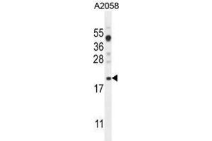 VCX1 Antibody (N-term) western blot analysis in A2058 cell line lysates (35 µg/lane). (VCX 抗体  (N-Term))