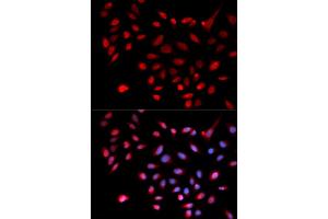 Immunofluorescence analysis of U2OS cells using CDK9 antibody (ABIN5970745). (CDK9 抗体)