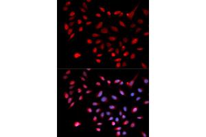 Immunofluorescence analysis of U2OS cells using CDK9 antibody (ABIN5970745). (CDK9 抗体)
