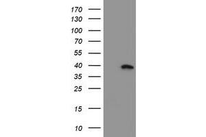 Western Blotting (WB) image for anti-Myeloid Leukemia Factor 1 (MLF1) antibody (ABIN1499496) (MLF1 抗体)
