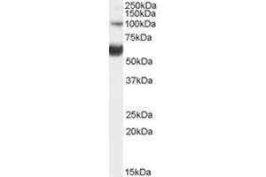 Image no. 1 for anti-HNF1 Homeobox B (HNF1B) (Internal Region) antibody (ABIN375249) (HNF1B 抗体  (Internal Region))