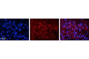 Rabbit Anti-DND1 Antibody     Formalin Fixed Paraffin Embedded Tissue: Human Pineal Tissue  Observed Staining: Cytoplasmic in pinealocytes  Primary Antibody Concentration: 1:100  Other Working Concentrations: 1/600  Secondary Antibody: Donkey anti-Rabbit-Cy3  Secondary Antibody Concentration: 1:200  Magnification: 20X  Exposure Time: 0. (DND1 抗体  (C-Term))