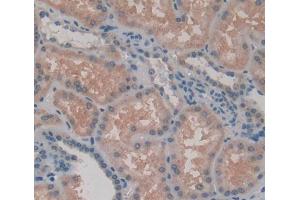 Used in DAB staining on fromalin fixed paraffin- embedded kidney tissue (Rhotekin 抗体  (AA 309-416))