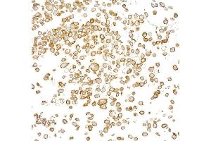 Immunocytochemistry (ICC) image for anti-Epidermal Growth Factor Receptor (EGFR) (C-Term) antibody (ABIN7795642)