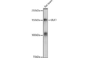 Western blot analysis of extracts of Rat brain, using ULK1 antibody (ABIN6134005, ABIN6149921, ABIN6149922 and ABIN6224624) at 1:500 dilution. (ULK1 抗体  (AA 400-499))