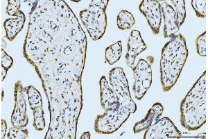 IHC analysis of MOV10 using anti-MOV10 antibody (ABIN7600236). (MOV10 抗体  (AA 167-772))