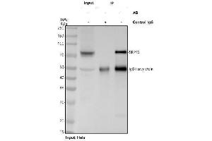 anti-Signal Recognition Particle 72kDa (SRP72) (AA 40-460) antibody