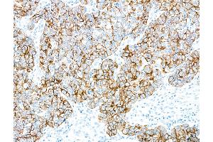 Immunohistochemistry (IHC) image for anti-Keratin 7 (KRT7) (C-Term) antibody (ABIN7455167)