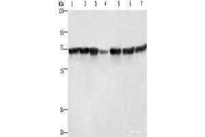 Western blot analysis of Hela cells HT29 cells human fetal liver tissue Human testis tissue 231 cells K562 cells human bladder transitional cell carcinoma tissue using LMNB1 Polyclonal Antibody at dilution of 1:750 (Lamin B1 抗体)