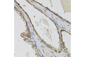 Immunohistochemistry of paraffin-embedded human prostate using PTK7 antibody at dilution of 1:100 (x40 lens). (PTK7 抗体)