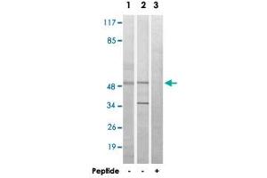 Western blot analysis of extracts from HeLa cells (Lane 1) and Jurkat cells (Lane 2 and lane 3), using MYLIP polyclonal antibody . (MYLIP 抗体)