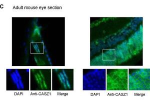 Immunofluorescence of Rabbit anti-CASZ1 Antibody. (CASZ1 抗体  (Internal Region))