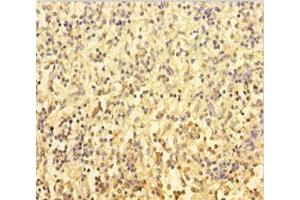 Immunohistochemistry of paraffin-embedded human spleen tissue using ABIN7174116 at dilution of 1:100