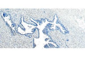 (ABIN185182) Negative Control showing staining of paraffin embedded Human Prostate, with no primary antibody. (VPS35 抗体  (C-Term))