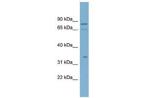 SLC5A9 antibody used at 1 ug/ml to detect target protein. (SLC5A9 抗体)
