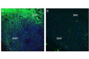 SLC41A2 抗体  (Extracellular, N-Term)