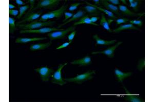 Immunofluorescence of purified MaxPab antibody to CAPN10 on HeLa cell. (CAPN10 抗体  (AA 1-672))