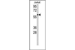 Image no. 1 for anti-Cytochrome P450, Family 2, Subfamily C, Polypeptide 9 (CYP2C9) (N-Term) antibody (ABIN360238)