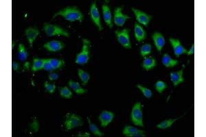 Immunofluorescence (IF) image for anti-Deiodinase, Iodothyronine, Type II (DIO2) (AA 74-222) antibody (ABIN7173972)
