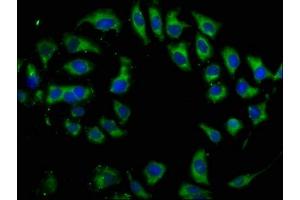 Immunofluorescence staining of A549 cells with ABIN7173972 at 1:133, counter-stained with DAPI. (DIO2 抗体  (AA 74-222))