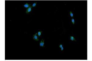 IF analysis of DRP1/DNM1L using anti-DRP1/DNM1L antibody (ABIN7602180). (Dynamin 1-Like 抗体  (AA 618-736))