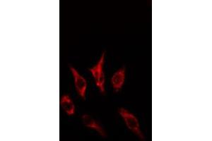 ABIN6274613 staining HepG2 cells by IF/ICC. (CCRL1 抗体  (C-Term))