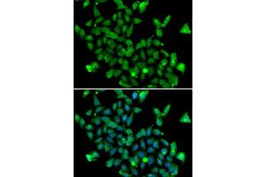 Immunofluorescence analysis of MCF-7 cells using ASPA antibody (ABIN6127373, ABIN6137211, ABIN6137212 and ABIN6223094). (ASPA 抗体  (AA 1-313))