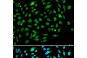 Immunofluorescence analysis of A549 cells using ING3 Polyclonal Antibody (ING3 抗体)