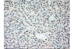 Immunohistochemistry (IHC) image for anti-Cardiac Troponin I (TNNI3) (AA 1-210) antibody (ABIN1490609) (TNNI3 抗体  (AA 1-210))