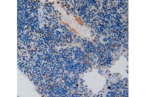 Used in DAB staining on fromalin fixed paraffin- embedded spleen tissue (PAI1 抗体  (AA 141-389))