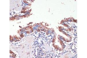 Immunohistochemistry of paraffin-embedded Rat lung using MSI1 Polyclonal Antibody at dilution of 1:200 (40x lens). (MSI1 抗体)