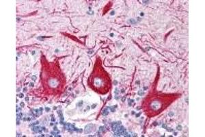 Immunohistochemistry (IHC) image for anti-Solute Carrier Family 15 (Oligopeptide Transporter), Member 1 (SLC15A1) (C-Term) antibody (ABIN2469866)