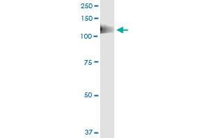 Immunoprecipitation (IP) image for anti-PTK2B Protein tyrosine Kinase 2 beta (PTK2B) (AA 682-871) antibody (ABIN560841)