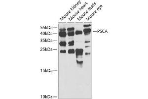 Western blot analysis of extracts of various cell lines, using PSCA antibody  at 1:1000 dilution. (PSCA 抗体  (AA 12-114))