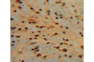 Used in DAB staining on fromalin fixed paraffin-embedded brain tissue (Midkine 抗体  (AA 22-140))